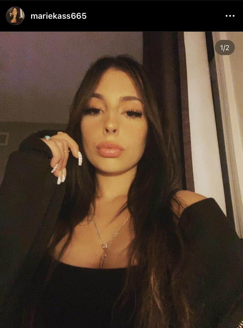 marie kass – Onlyfans Girl Nude Sexy Photos Leaked –