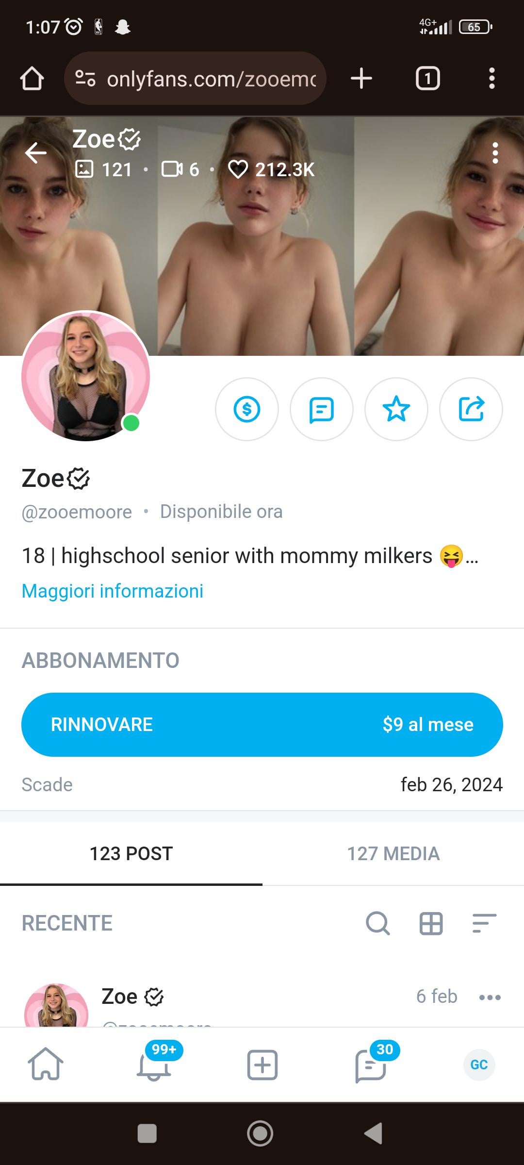 Zoe – Onlyfans Girl Nude Sexy Photos Leaked – 1